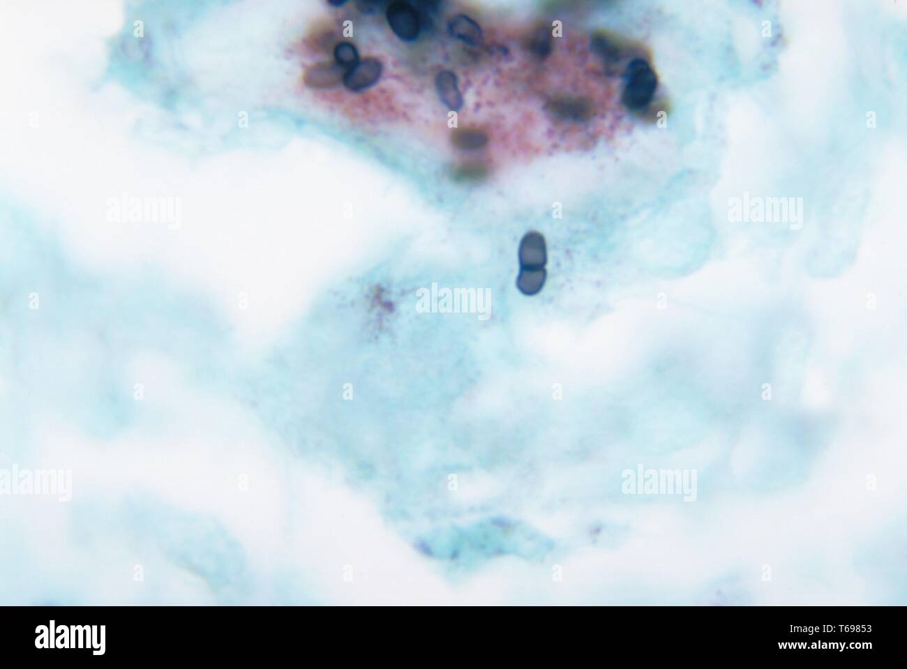 Methenamin silber Fleck photomicrograph des histopathologic Änderungen in einer Maus Hoden, penicilliosis durch Penicillium marneffei, 1972 verursacht. Bild mit freundlicher Genehmigung Zentren für Krankheitskontrolle und Prävention (CDC)/Dr. Libero Ajello. () Stockfoto