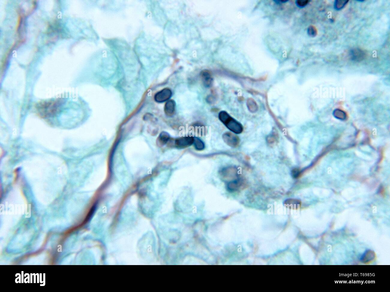 Methenamin silber Fleck photomicrograph des histopathologic Änderungen in einer Maus Hoden, penicilliosis durch Penicillium marneffei, 1972 verursacht. Bild mit freundlicher Genehmigung Zentren für Krankheitskontrolle und Prävention (CDC)/Dr. Libero Ajello. () Stockfoto