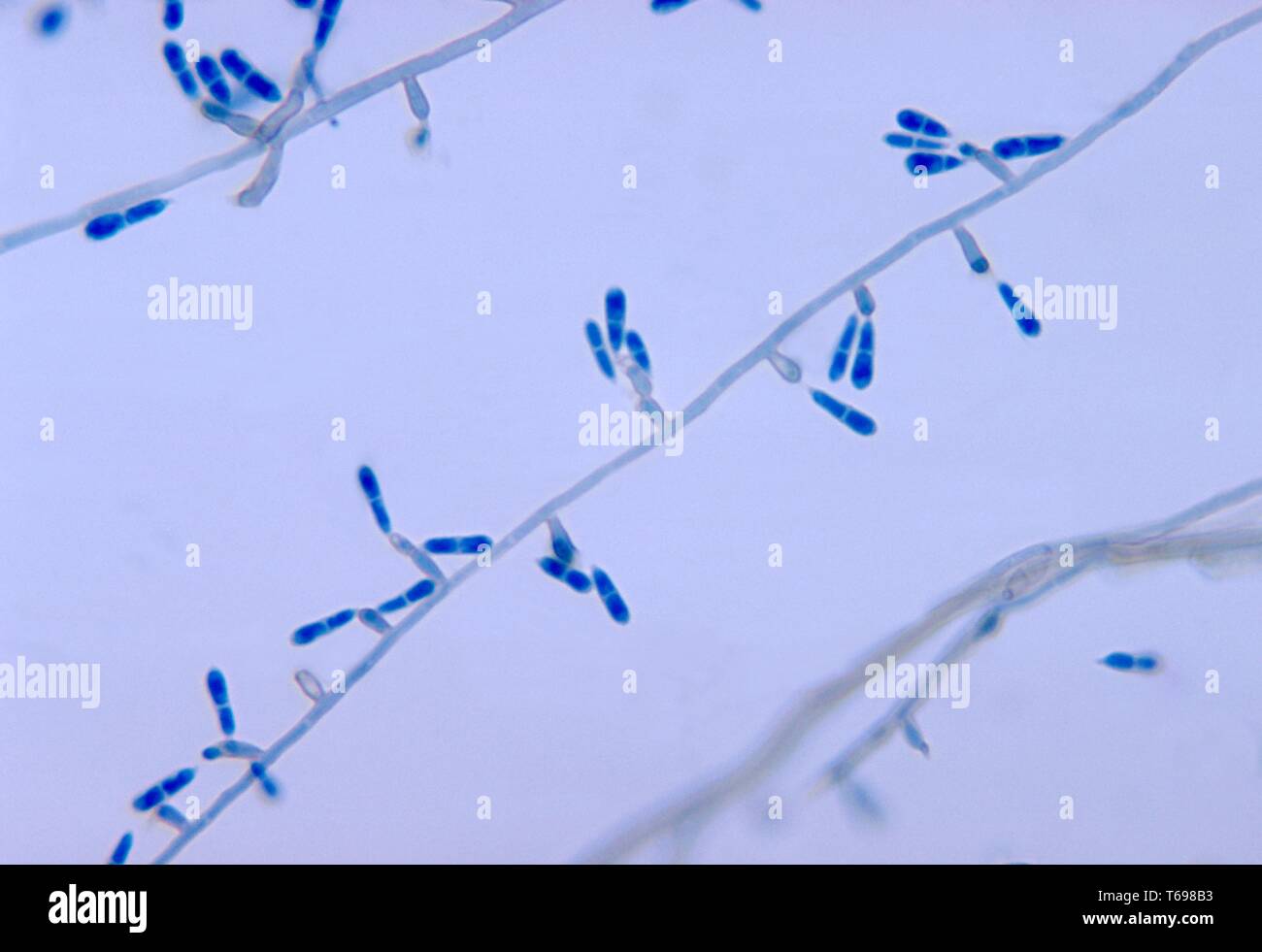 Photomicrograph von konidien auf conidiophores des Pilzes Ochroconis gallopavum (Dactylaria gallopava) getrennt von der Türkei Küken Gehirn Gewebeproben, 1971. Bild mit freundlicher Genehmigung Zentren für Krankheitskontrolle und Prävention (CDC)/Dr Lucille George. () Stockfoto