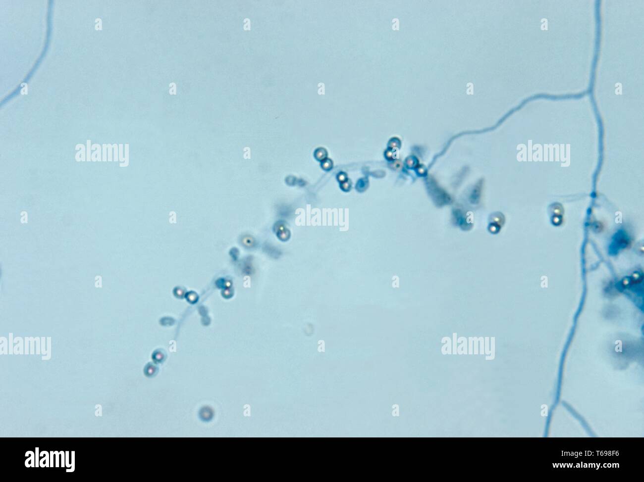 Photomicrograph der Myzelien und Paare von Sporen von Gram-positiven Bakterien der Gattung Microbispora, 1972. Bild mit freundlicher Genehmigung Zentren für Krankheitskontrolle und Prävention (CDC)/Dr Lucille K. Georg. () Stockfoto