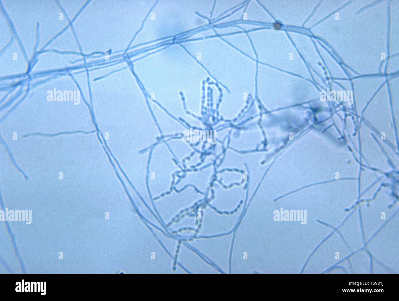 Photomicrograph der Ketten von Bakterien unter Antenne myzelien von der Gram-positiven Bakterien aerobe Nocardia, 1972 verursacht. Bild mit freundlicher Genehmigung Zentren für Krankheitskontrolle und Prävention (CDC)/Dr Lucille K. Georg. () Stockfoto
