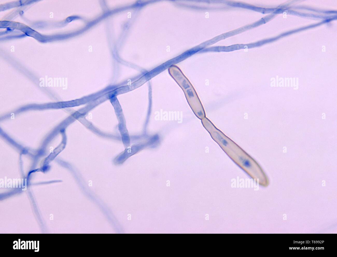 Photomicrograph die Konidien des Pilzes Corynespora cassiicola, 1970. Bild mit freundlicher Genehmigung Zentren für Krankheitskontrolle und Prävention (CDC). () Stockfoto