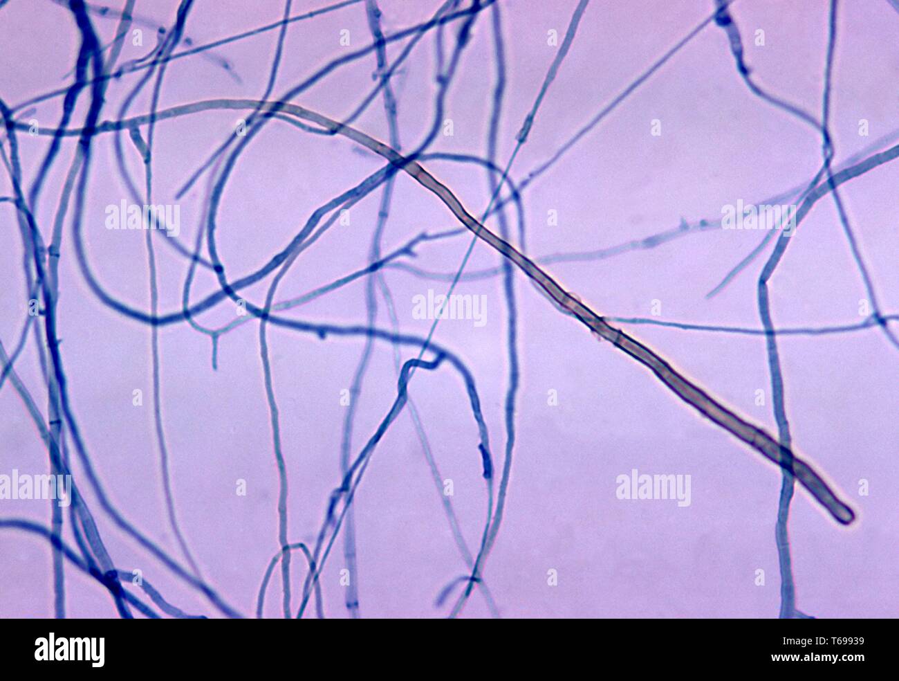 Photomicrograph eines conidiophore und conidium des Pilzes Corynespora cassiicola, 1970. Bild mit freundlicher Genehmigung Zentren für Krankheitskontrolle und Prävention (CDC). () Stockfoto