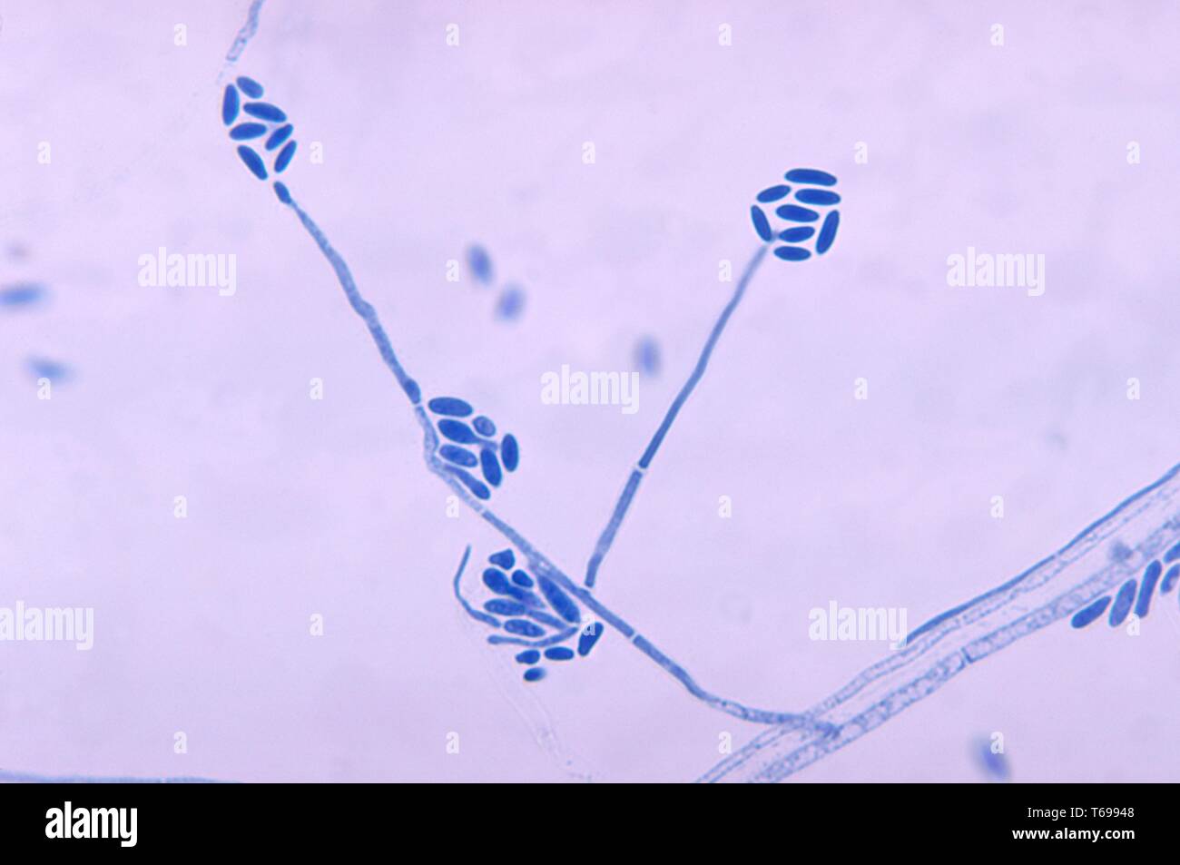 Photomicrograph der Konidien und conidiophores des Pilzes Acremonium falciforme, 1970. Bild mit freundlicher Genehmigung Zentren für Krankheitskontrolle und Prävention (CDC). () Stockfoto