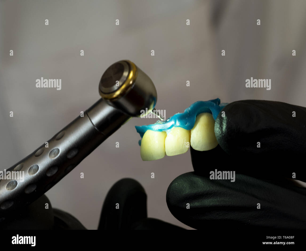 April 27, 2019 - Kiew, Ukraine - Zahnarzt gesehen ein cermet Zahnersatz mit Bor bei privaten Albert erste Klinik. Albert zunächst einen Zahnarzt, Binnenvertriebene aus Donezk und einer der führenden Ärzte unter den privaten Kliniken in Borispol, einem Vorort von Kiew. (Bild: © Igor Golovniov/SOPA Bilder über ZUMA Draht) Stockfoto