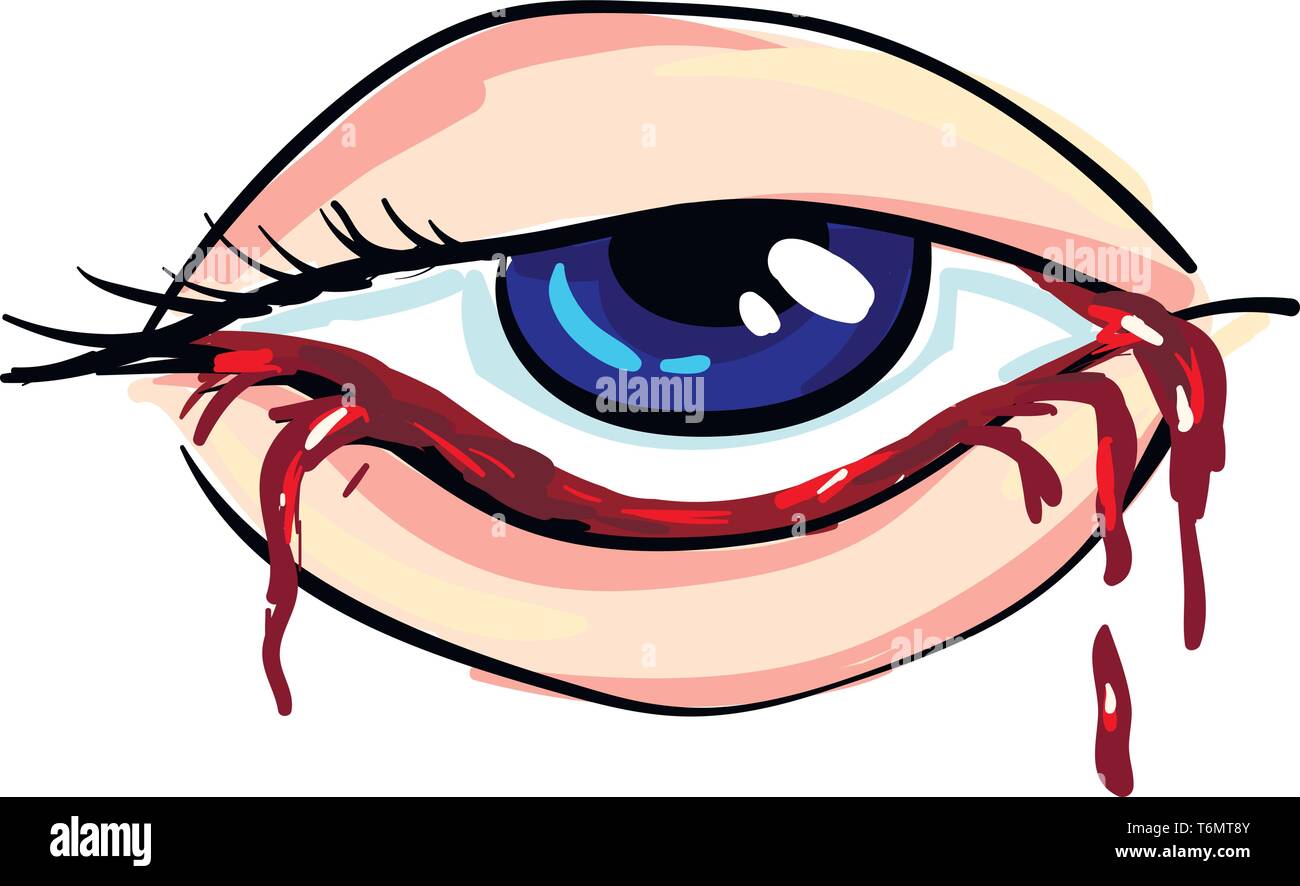 Blutiges Auge einer Frau Vector Illustration Stock Vektor