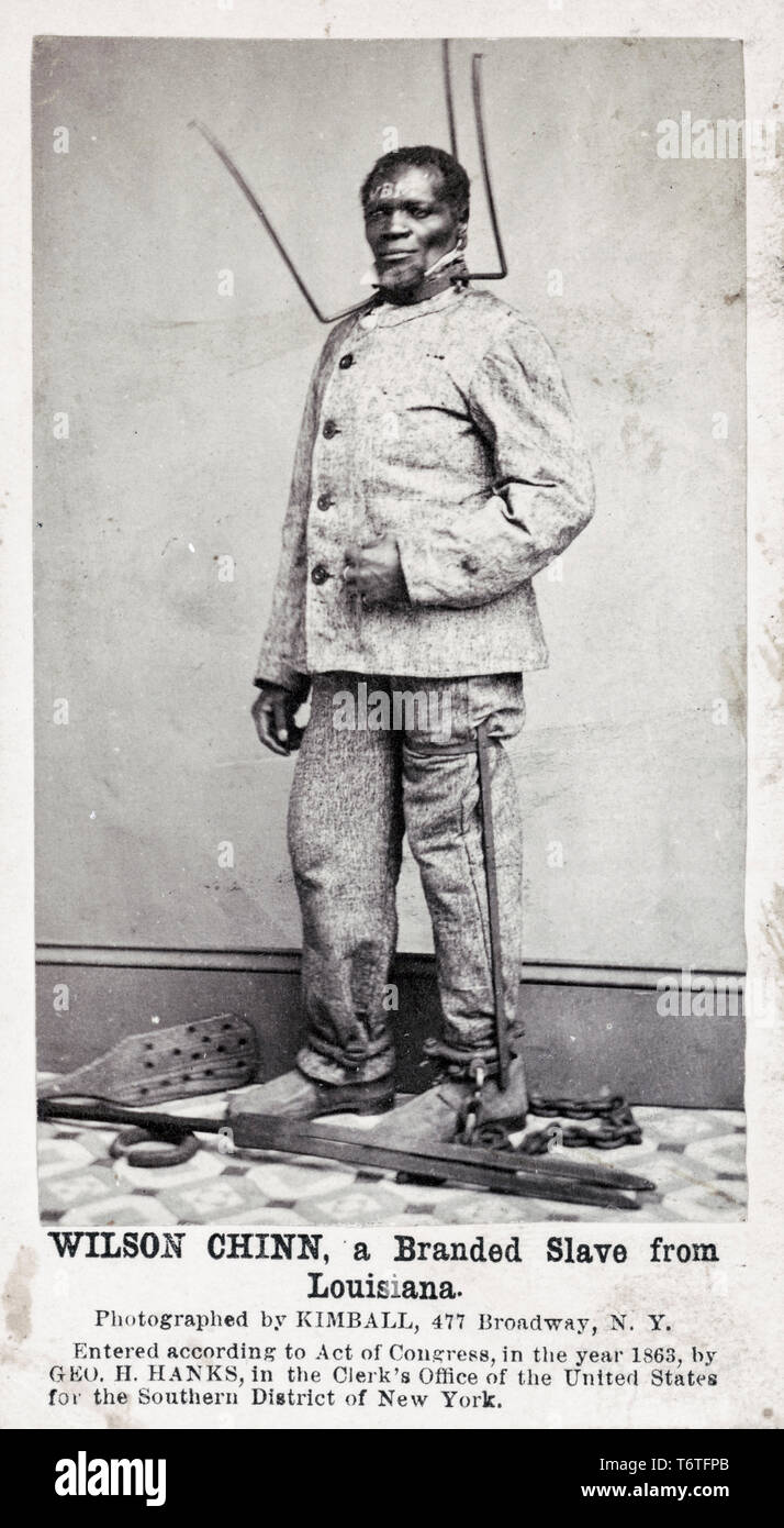 Wilson Chinn, einem ehemaligen Sklaven aus Louisiana, trug eine Bestrafung, Kragen und Fußfesseln und Ketten, amerikanischer Sklaverei, 1863 Stockfoto