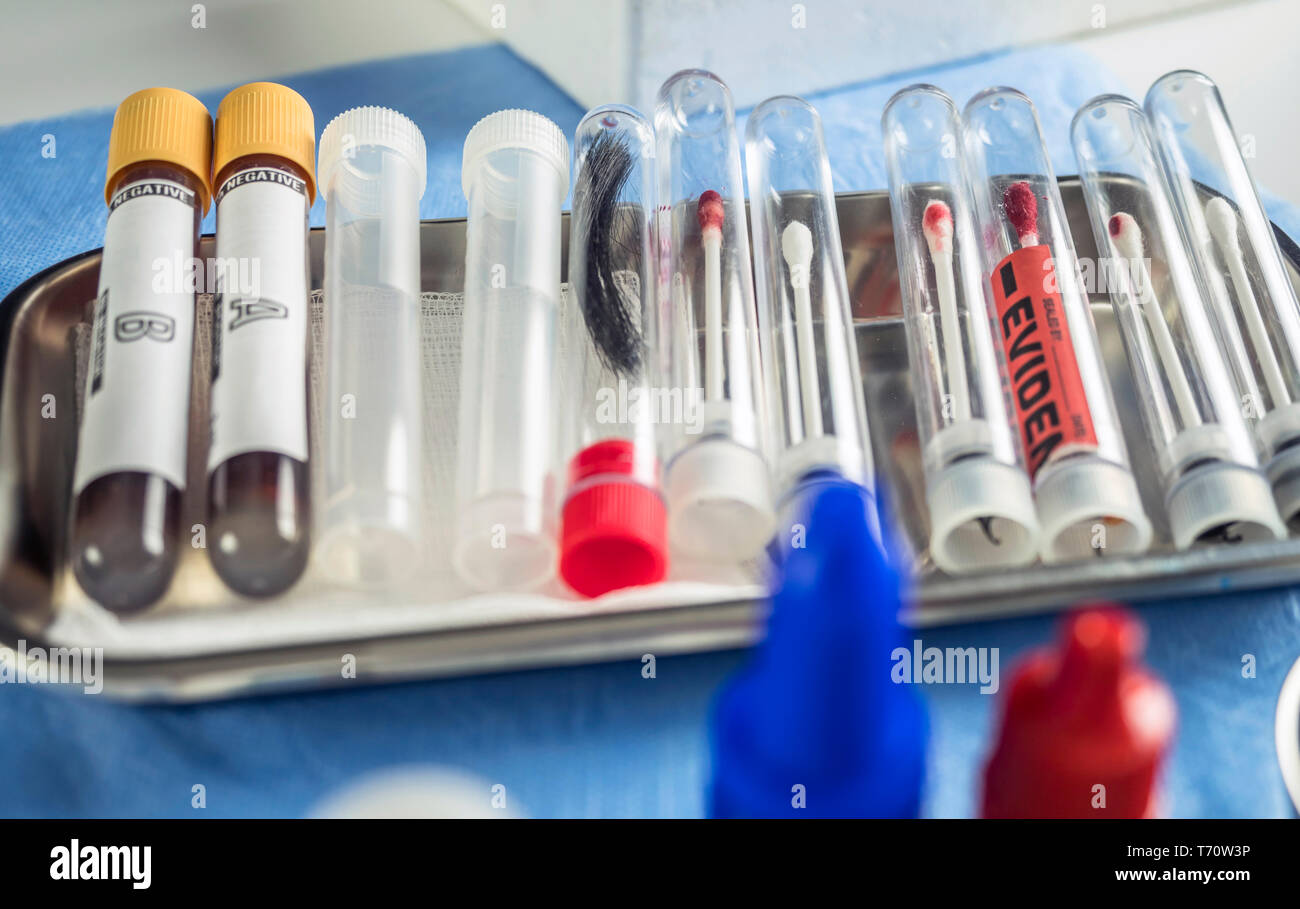 Verschiedene proben Haar und Blut im Labor wissenschaftlich-konzeptionellen Bild zu analysieren Stockfoto