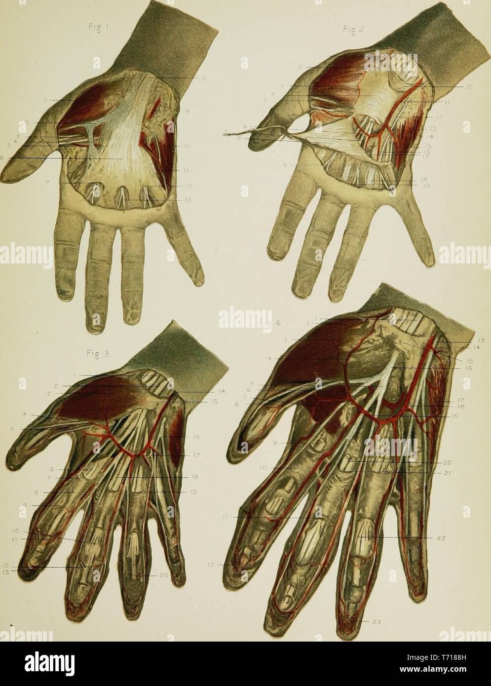 Anatomie Illustrationen der Handfläche der rechten Hand, aus dem Buch "Regionale Anatomie in ihrem Bezug zur Medizin und Chirurgie" durch McClellan George, 1891. Mit freundlicher Genehmigung Internet Archive. () Stockfoto