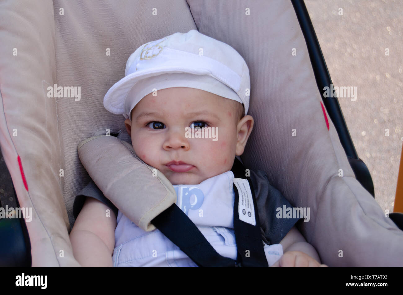 Cute sechs Monate altes Baby Bou in der Kinderwagen mit Mückenstichen auf seinem Gesicht. Stockfoto