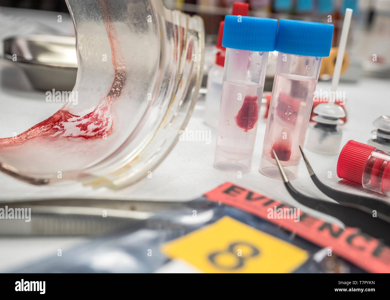 Reinigungsstäbchen mit Blutprobe im Labor untersucht werden, konzeptionelle Bild Stockfoto