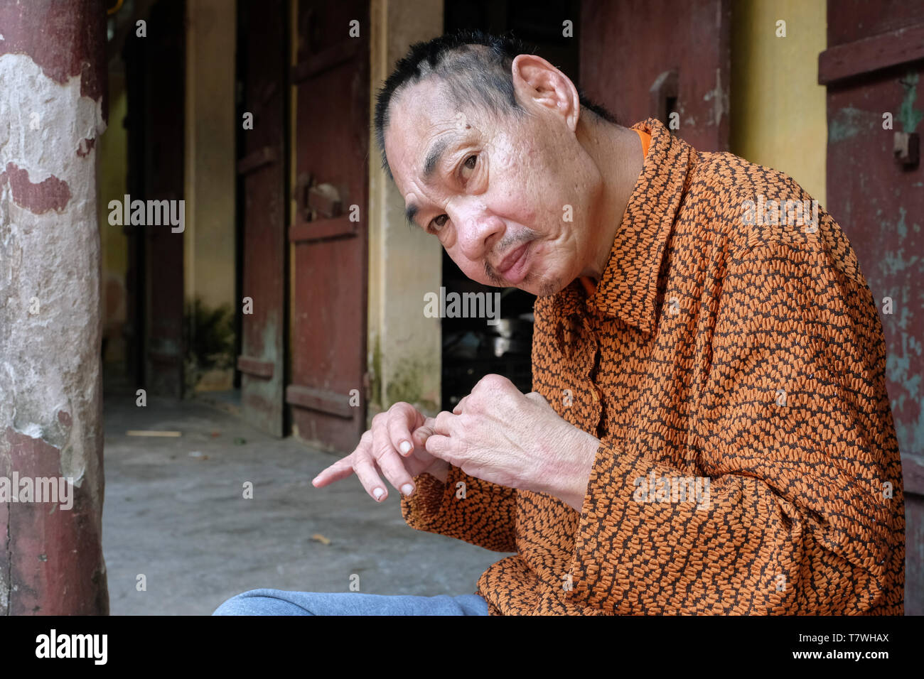 Agent Orange Opfer Minh lange Nguyen (64 Jahre) sitzt auf einem Stuhl vor das Haus seines Sohnes. Phu Ly Dorf (Ha Nam Provinz) in der Nähe von Hanoi, Vietnam Stockfoto