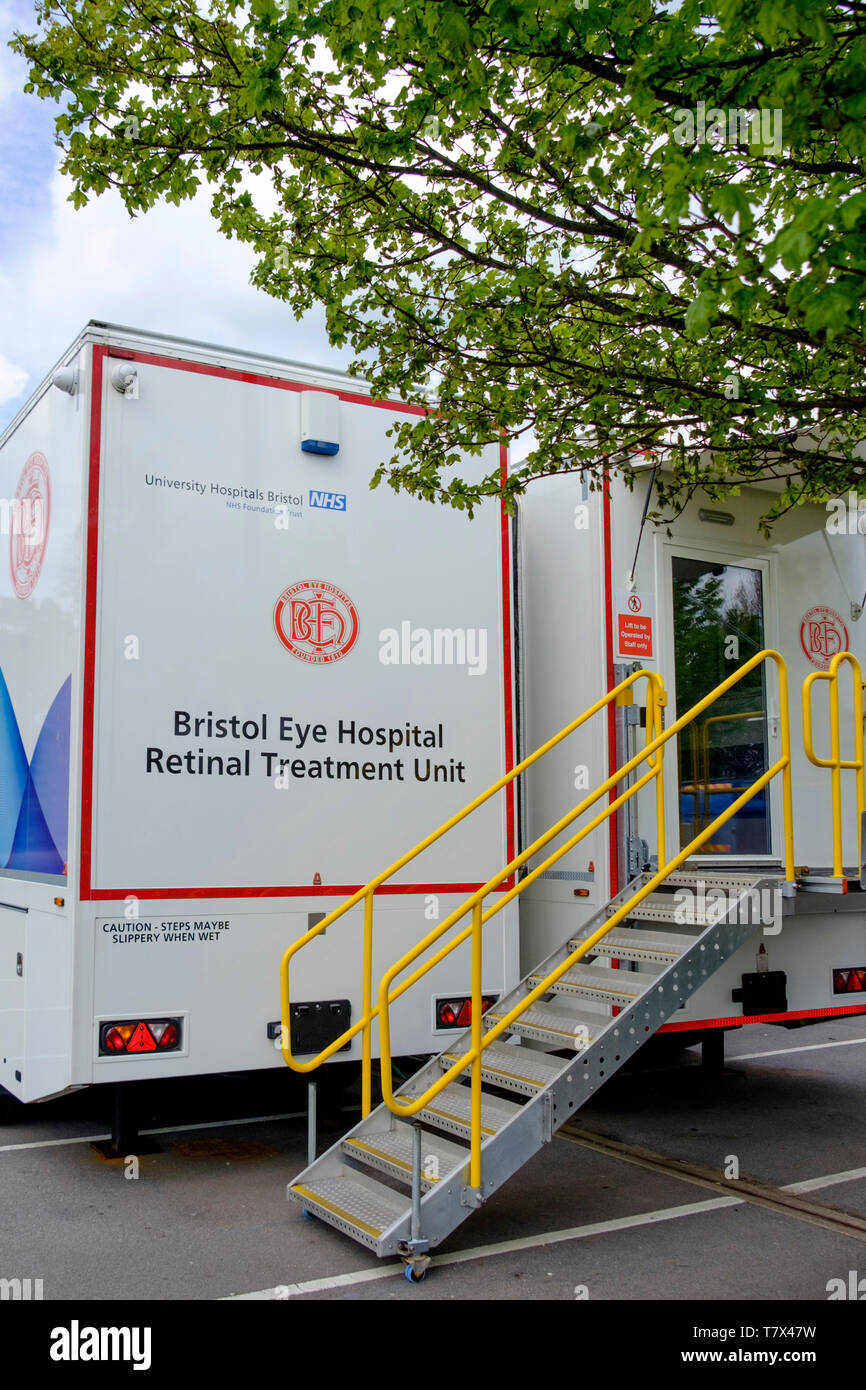Bristol Augenklinik Netzhaut Bestrahlungsgerät am Cribbs Causeway Einkaufszentrum, in der Nähe von Bristol UK; Bristol Auge; Krankenhaus; Behandlung der Netzhaut Einheit Stockfoto