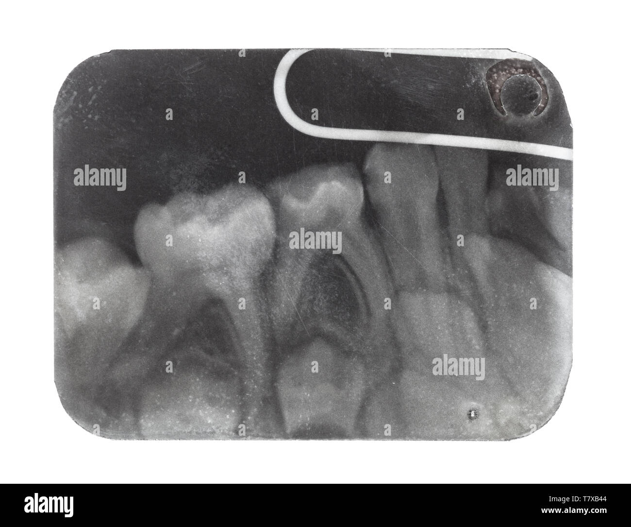 Film mit X-ray Bild von menschlichen Zähnen schließen bis auf weißem Hintergrund Stockfoto