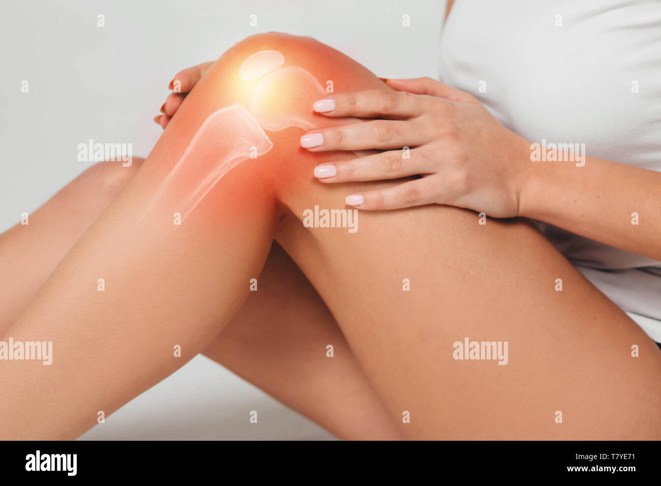 Frau tragen Sport Kleidung leiden unter Schmerzen im Knie. Close-up schmerzhafte Knie mit Knochen Stockfoto