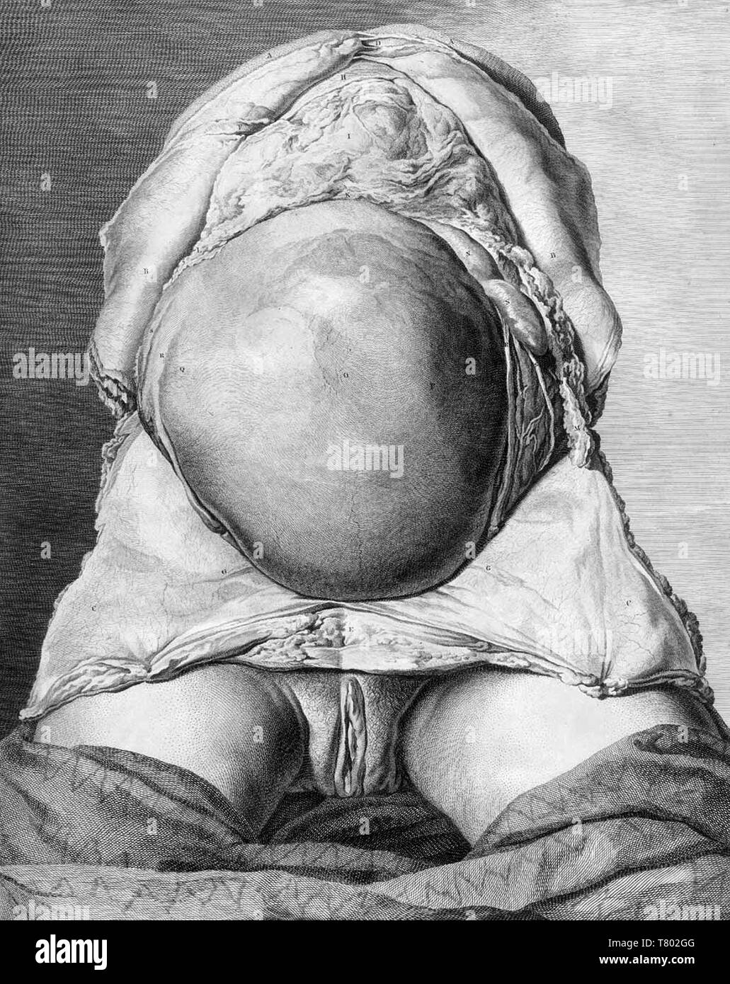 William Hunter, Anatomia uteri humani gravidi, 1774 Stockfoto