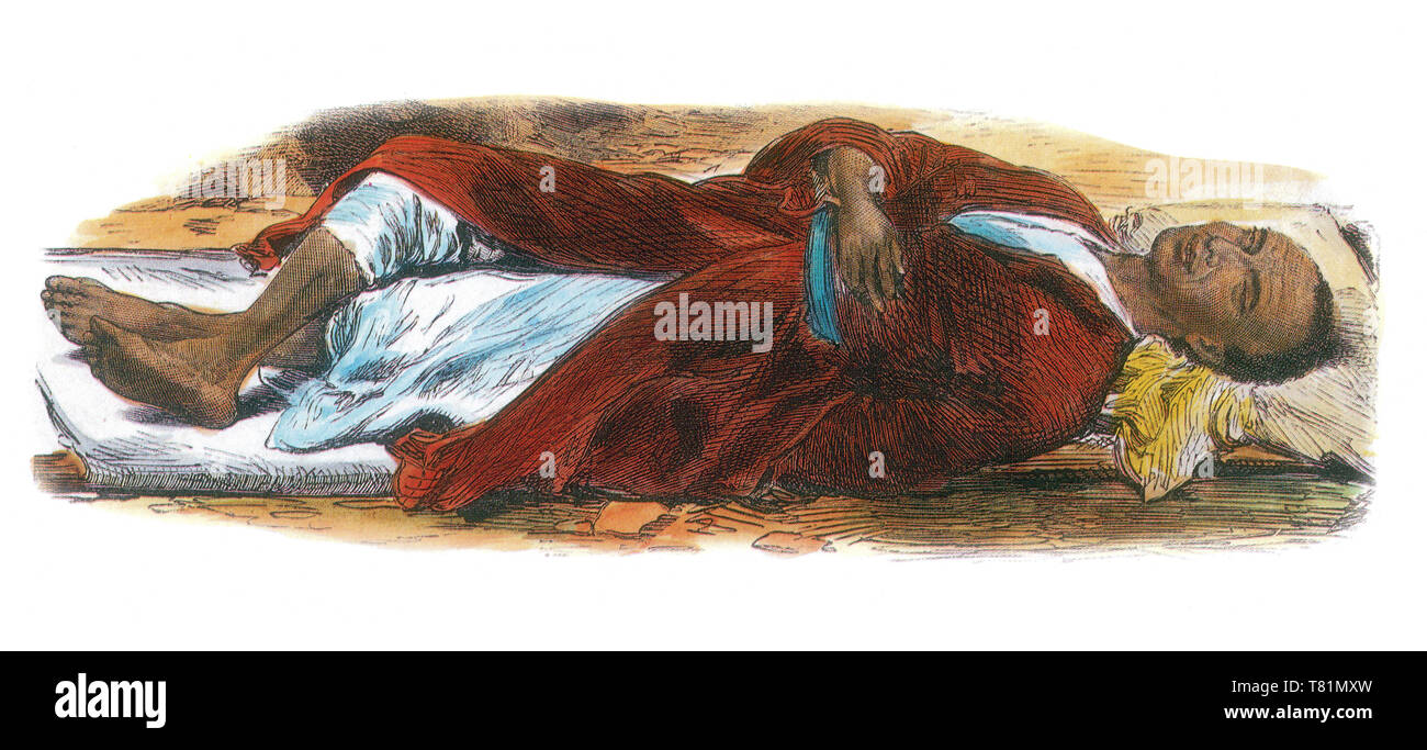 Körper des Tewodros II., 1868 Stockfoto