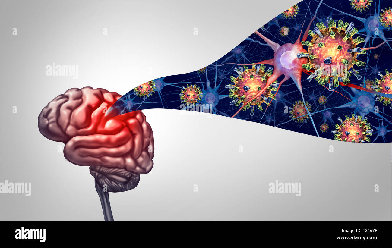 Meningitis und Enzephalitis virale Infektion im Gehirn als medizinisches Konzept mit 3D-Illustration Elemente. Stockfoto
