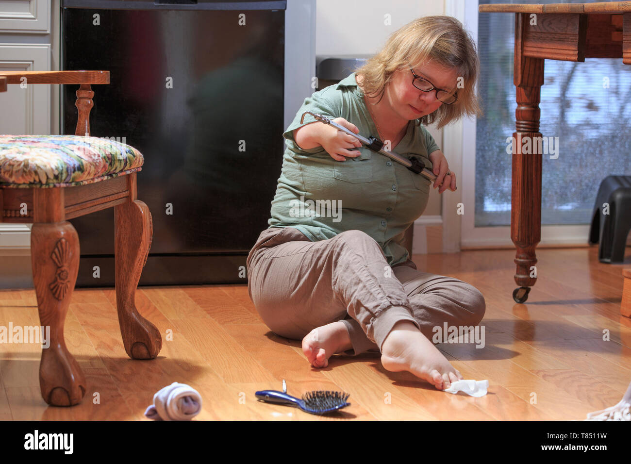 Frau mit TAR-Syndrom, ein Element mit ihren Füßen Stockfoto