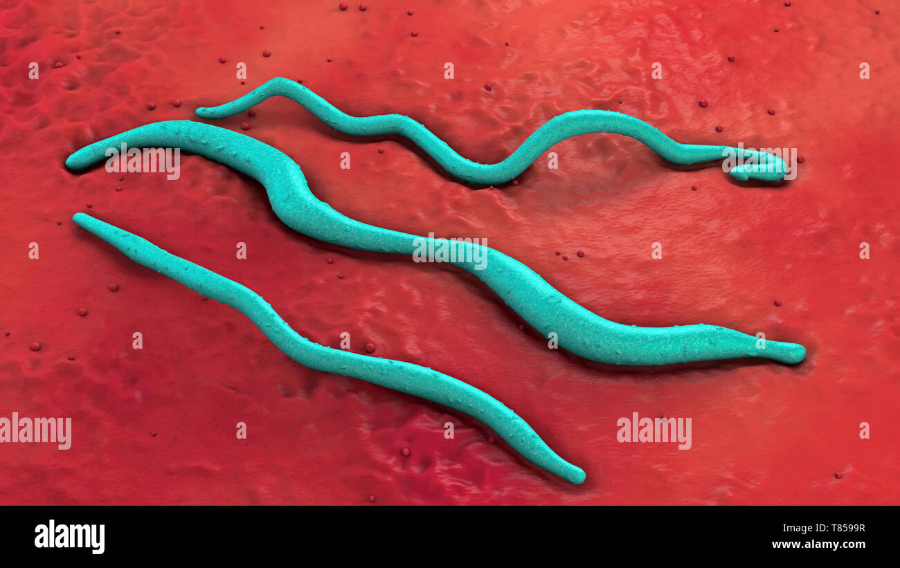 Borreliose Bakterien, Abbildung Stockfoto