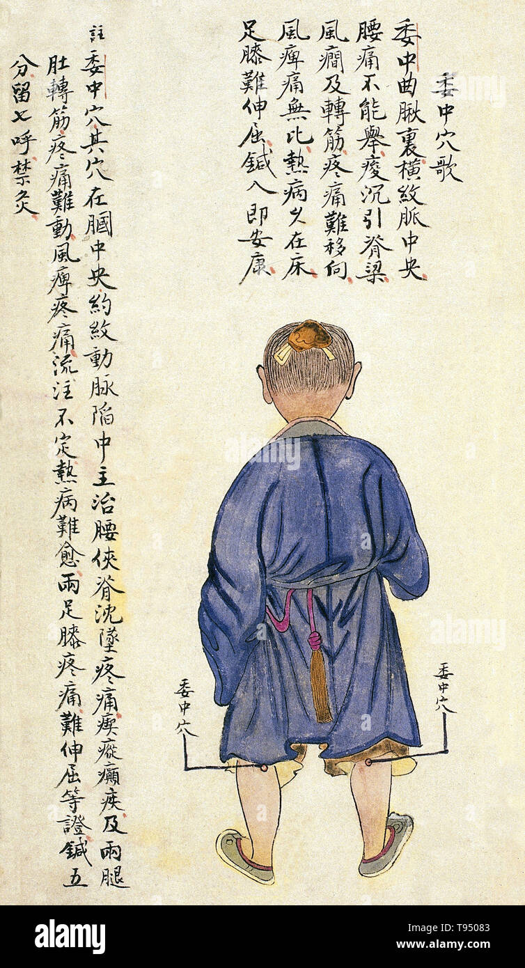 Acu - moxa Punkt Diagramm zeigt die weizhong (Mitte der Alston), von Chuanwu lingji Lu (Aufzeichnung der souveränen Lehren), von Zhang Youheng, eine Abhandlung über die acu - moxa in zwei Bänden. Diese Arbeit überlebt nur in einer Handschrift Entwurf, 1869 (im 8. Jahr der Tongzhi Herrschaft der Qing-dynastie) erledigt). Die weizhong Punkt ist auf der Rückseite des Knies in der Mitte der Fossa poplitea Knick. Es kann bis zu einer Tiefe von 5 fen (1 fen [0,1 Cun/Chinesisch proportional inch]=c genadelt werden. 0. Stockfoto