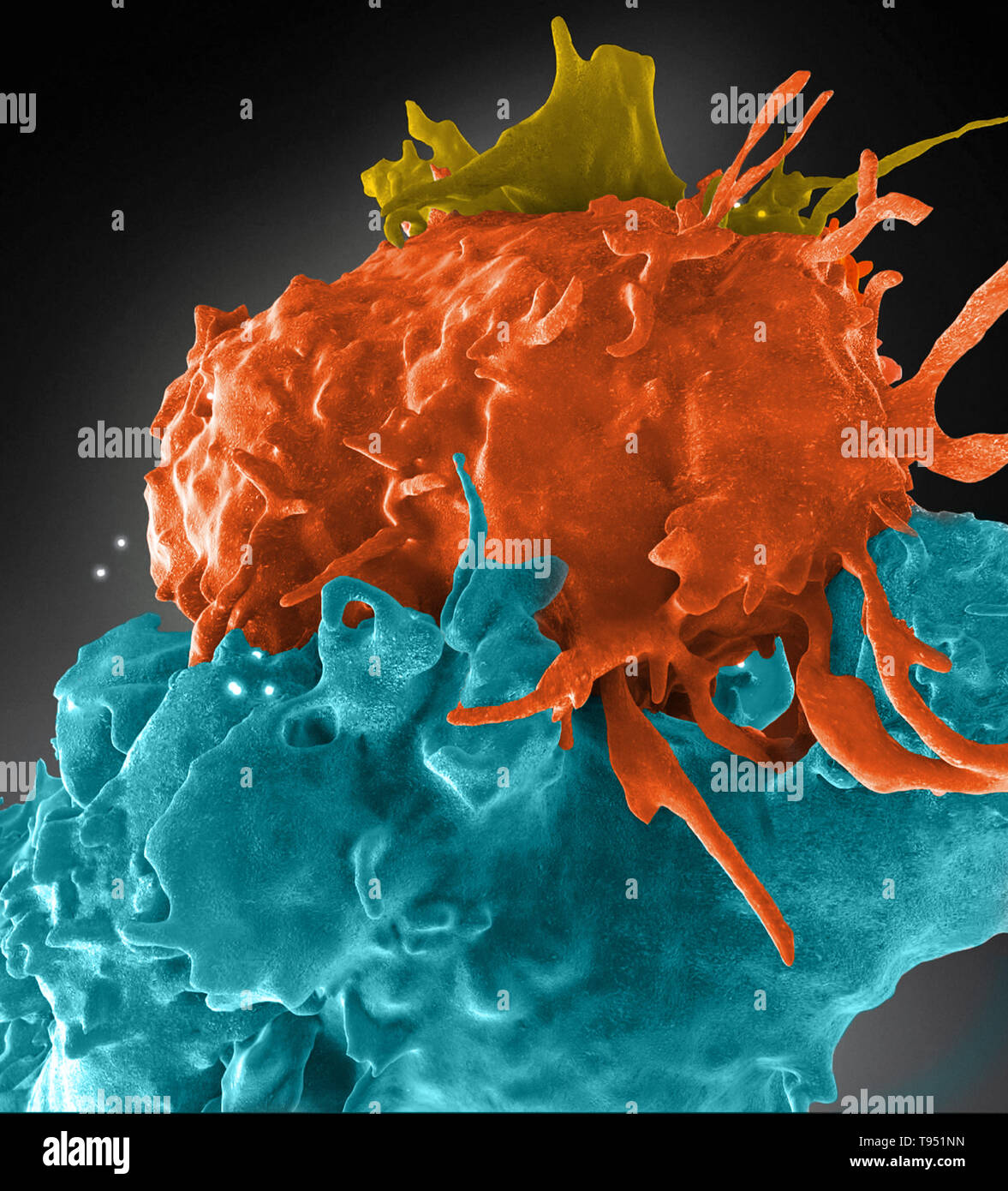 Dreidimensionale Struktur von HIV-Infizierten (Blau, Grün) und nicht infizierten (braun, violett) T-Zellen interagieren. Eine Zelle (braun) hat eine Verlängerung aufgewickelt um seine nichtinfizierten Nachbar (lila) zu erreichen, eine infizierte Zelle (blau). Erworbenen Immunschwäche-Syndrom (AIDS) ist eine chronische, potentiell lebensbedrohliche Erkrankung, die durch das Human Immunodeficiency Virus (HIV). Durch die Schädigung des Immunsystems, HIV beeinträchtigt die Fähigkeit des Körpers, den organismen, die Krankheit zu bekämpfen. Stockfoto
