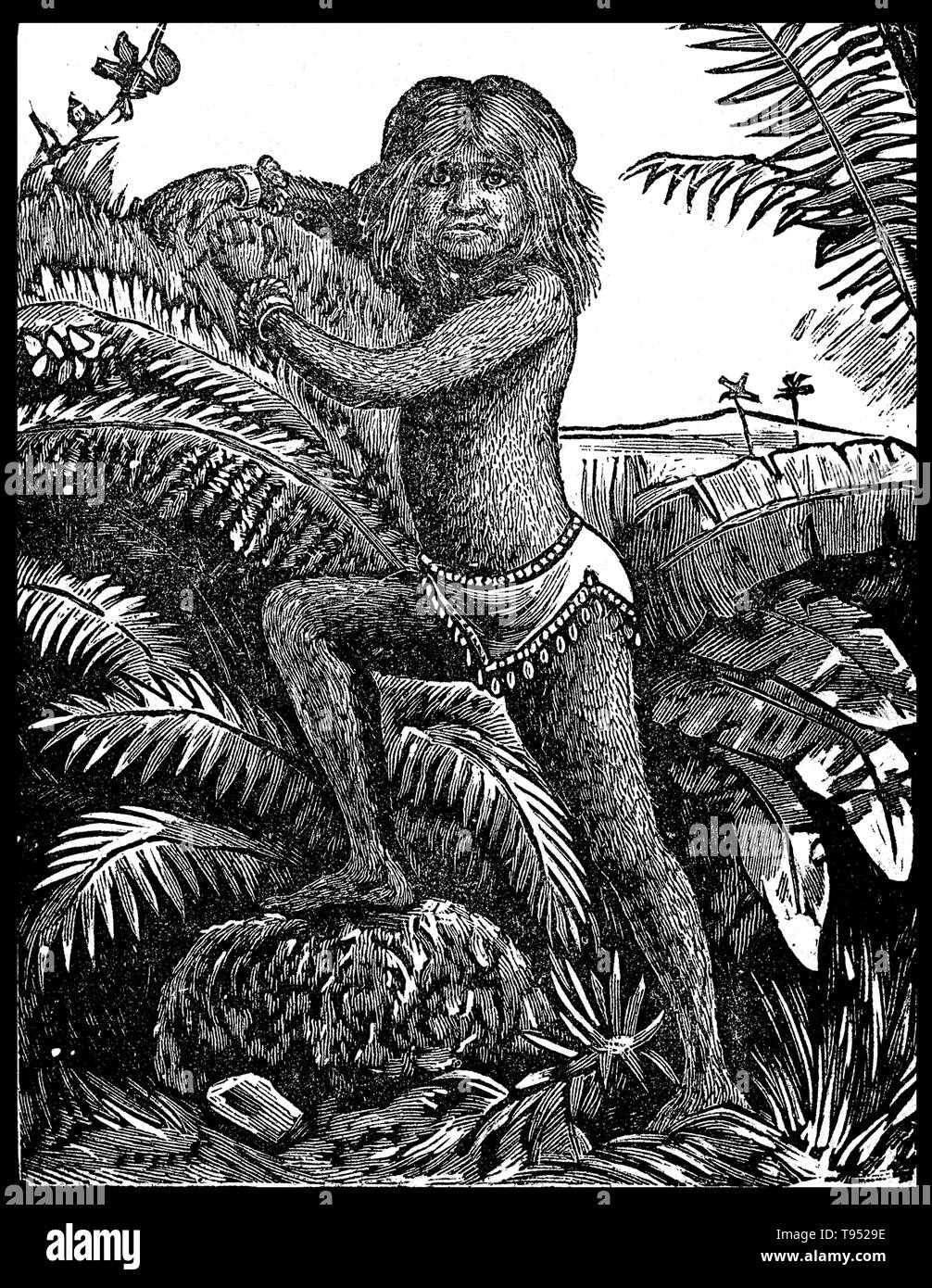Krao Re di Roma (1876 - 16. April 1926) war ein US-amerikanischer sideshow Interpret geboren mit hypertrichose. Es wird behauptet, dass im Januar 1881, Krao und ihre Eltern in Laos gefangen genommen wurden während einer Expedition geleitet durch die Explorer Carl Bock. Ein Anthropologe, George Shelly, war Teil der Expedition und übernahm Krao. Sie war als Teil eines primitiven Stammes Menschen namens 'Kraos - monink' alle von wem wurden in Haar bedeckt beschrieben und in den Bäumen lebte. Stockfoto