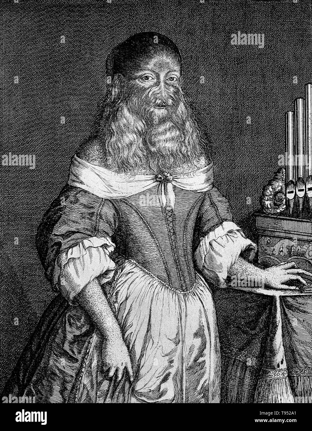 Barbara van Beck (18. Februar 1629-?) war eine deutsche Frau, die von einer seltenen genetischen Erkrankung, hypertrichosis Universalis, auch als Schloss Ambras oder Werwolf Syndrom bekannt ist. Ihre Eltern hatten keine Zeichen dieser erblichen Zustand so ihre Geburt muss eine große Überraschung auf Sie. Sie kam zuerst zum Vorsprung im Jahre 1639, wenn der Anatom Thomas Bartholin sah sie in Kopenhagen vertreten. Er stellte fest, dass ihr gesamter Körper war mit weichen, blonden Haaren bedeckt und einer üppigen Bart". Stockfoto