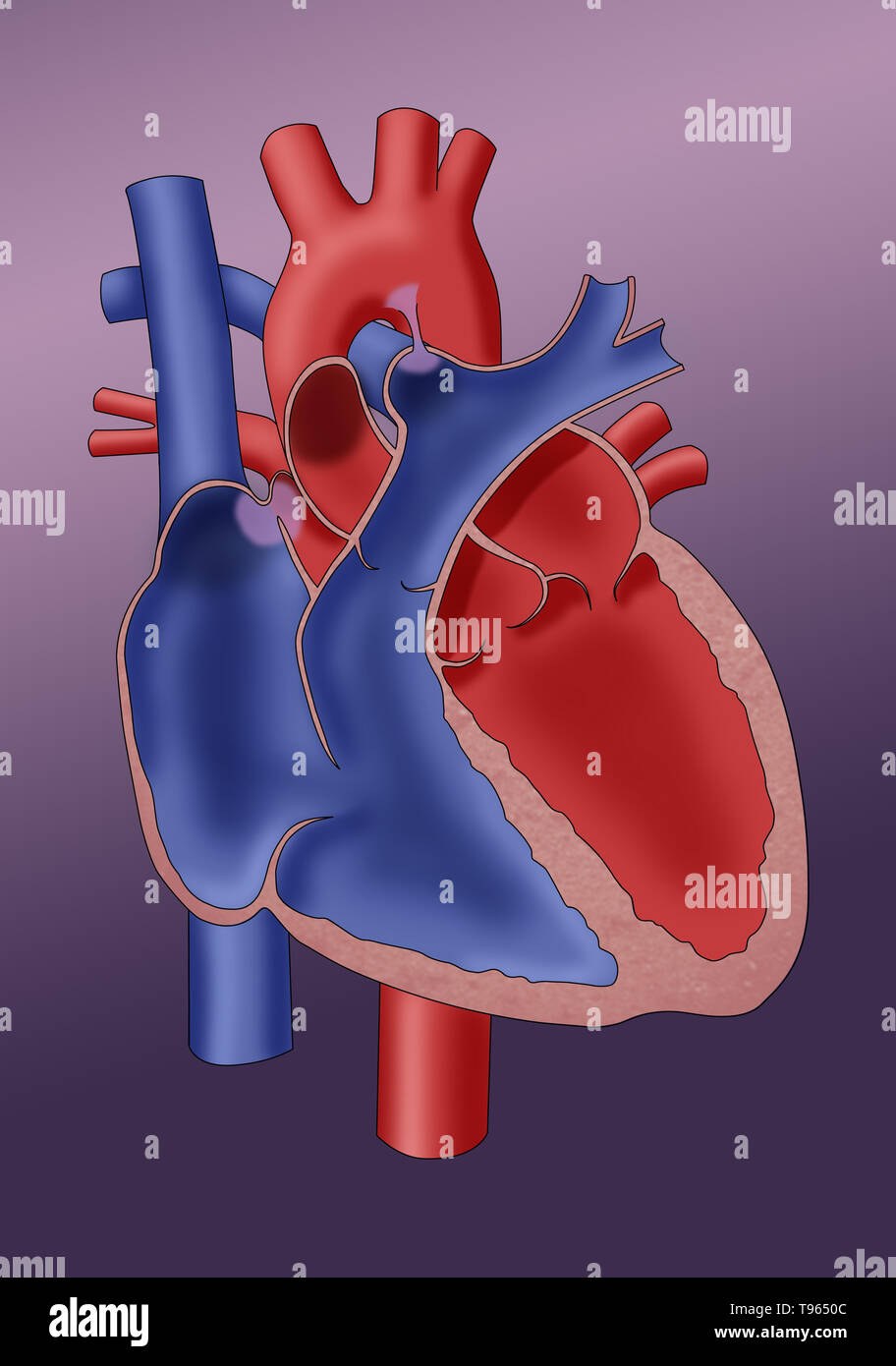16+ Herz anatomie neugeborenes