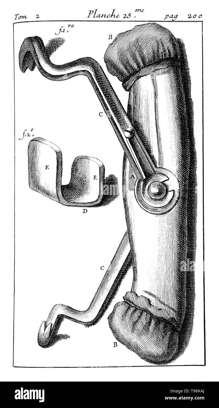 Zahnmedizinische Pelikan für Zahnextraktion. Tome 2. Planche 25. Seite 200. Pierre Fauchard (1678 - 22. März 1761) war ein französischer Arzt, gutgeschrieben als der Vater der modernen Zahnheilkunde. Er ist bekannt für das Schreiben der erste vollständige wissenschaftliche Beschreibung von Zahnheilkunde bekannt, Le Chirurgien Dentiste (Der Chirurg Zahnarzt), im Jahre 1728 veröffentlicht. Stockfoto