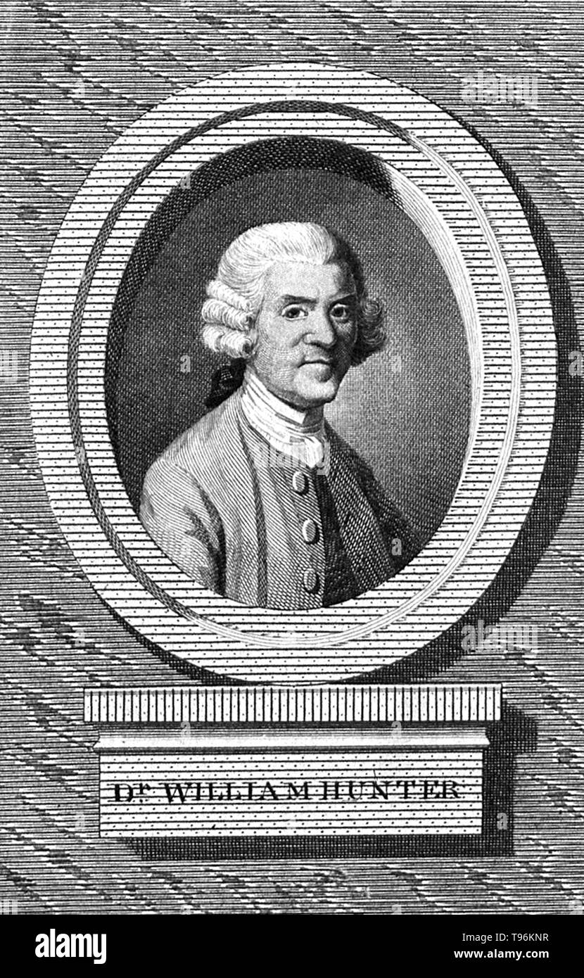 William Hunter (Mai 23, 1718 - März 30, 1783) war ein schottischer Anatom und Arzt. Jäger als resident Schüler zu William Smellie und er war in der Anatomie im St George's Hospital, London ausgebildet, in der Geburtshilfe spezialisiert hat. Seine höfischen Umgangsformen und ein vernünftiges Urteil half ihm, bis er der führende obstetric Berater von London. Zu orthopädischen Chirurgen er berühmt für seine Studien über Knochen und Knorpel ist. Stockfoto