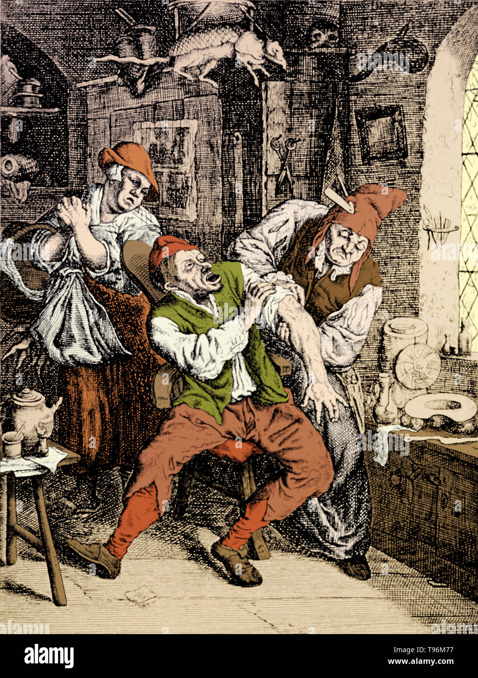 Mann, auf einem Stuhl sitzend, ist in seinem Arm bandagiert, das durch das Dorf Arzt. Eine betroffene Frau wartet im Hintergrund. In Europa im 13. Jahrhundert eine neue Art der Handwerker in den Städten hervor; die Friseur-Chirurg. Sie schneiden die Haare, Zähne gezogen und einfache Operationen wie Amputationen und gebrochene Knochen und auf der Suche nach Soldaten, die während oder nach einer Schlacht. Friseur - Chirurgen durchgeführt, eine Technik zur Rekonstruktion der Nase ebnet den Weg für die Entwicklung der modernen plastischen Chirurgie. Stockfoto