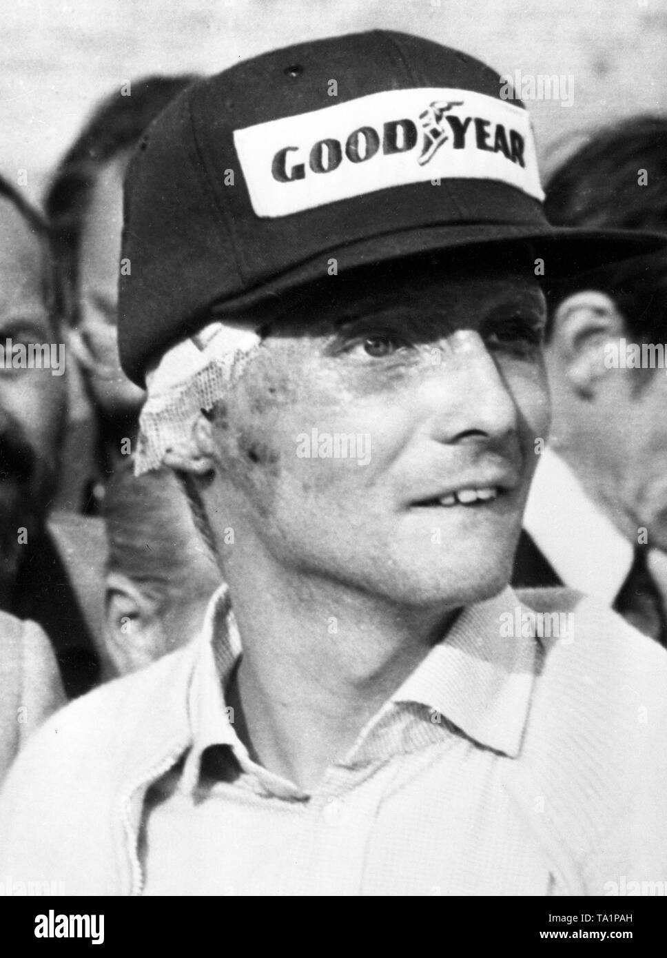 Niki Lauda nach seinem hauttransplantaten Betrieb Nach seinem Absturz in  der Grand Prix von Deutschland 1976 auf dem Nürburgring. * Großbritannien  NUR VERWENDEN Stockfotografie - Alamy