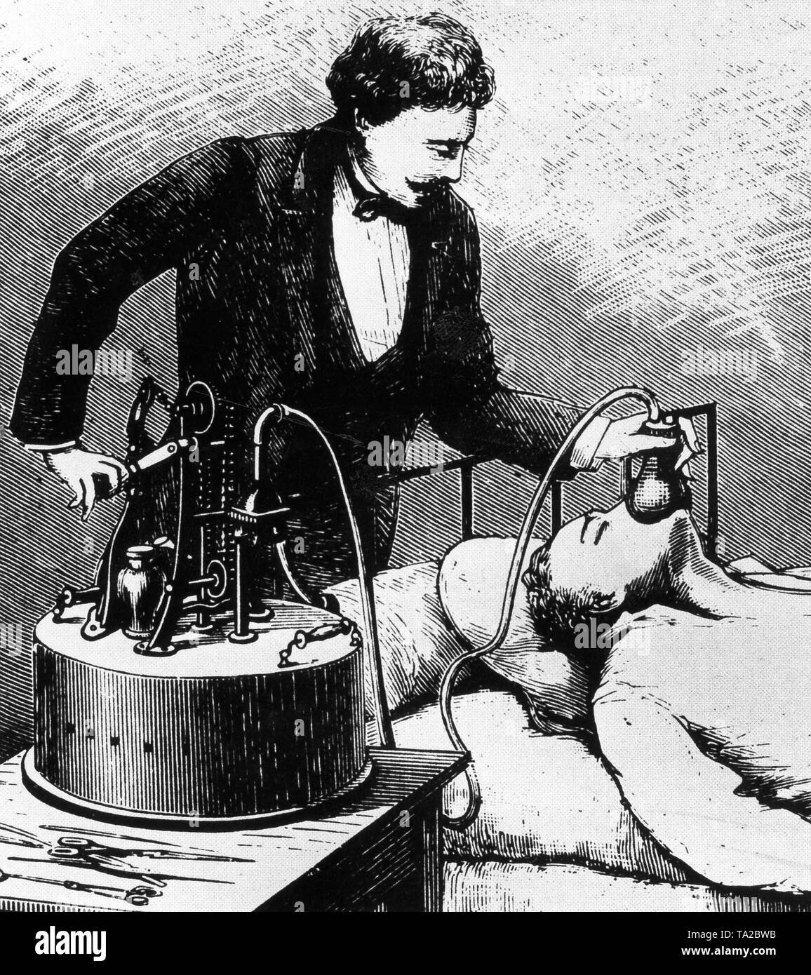Anästhesie eines Patienten mit Chloroform, der Arzt immer noch trägt einen Anzug, ca. 1875 Stockfoto