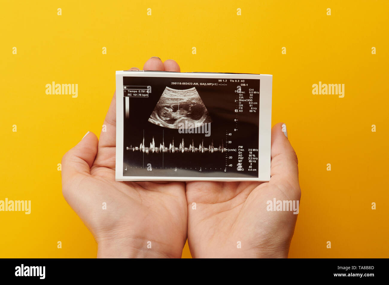 Frau, die Ultraschall Bild von Baby in der Schwangerschaft Zeit Stockfoto