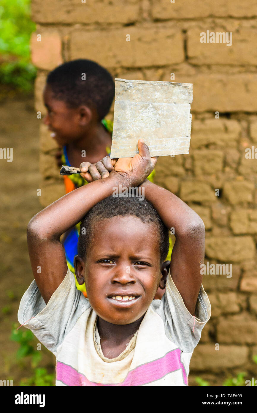 Junge mit einer geschwollenen Backe in einem Dorf in Malawi Stockfoto