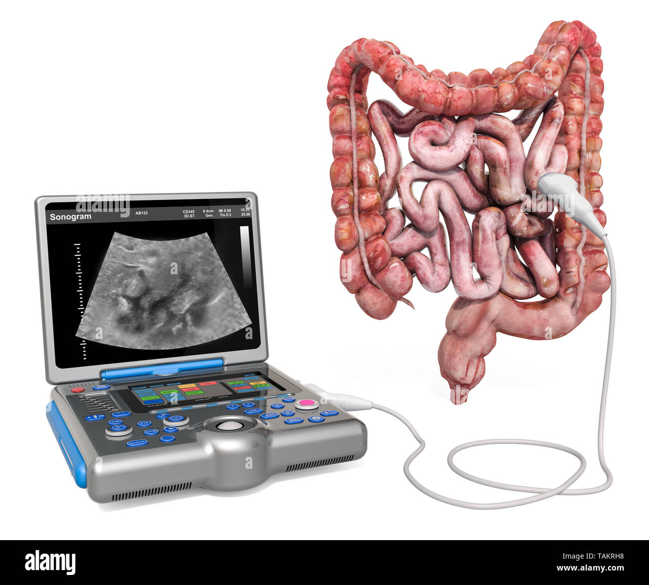 Verdauungsfördernde Ultraschall Konzept. Menschlichen Darms mit medizinischen Ultraschall Diagnose Maschine, 3D-Rendering auf weißem Hintergrund Stockfoto