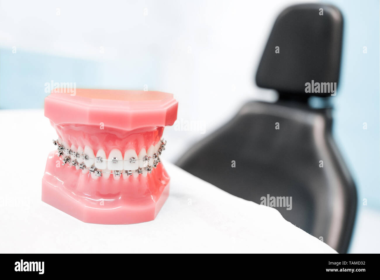 Zahnmedizinisches Modell mit Klammern - in Zahnarzt Klinik oder Kieferorthopädie Stockfoto