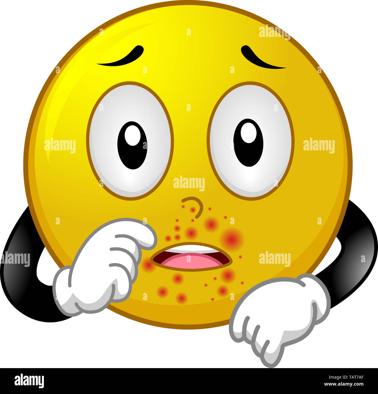 Abbildung: ein Smiley Maskottchen mit Impetigo oder Haut Infektion Stockfoto