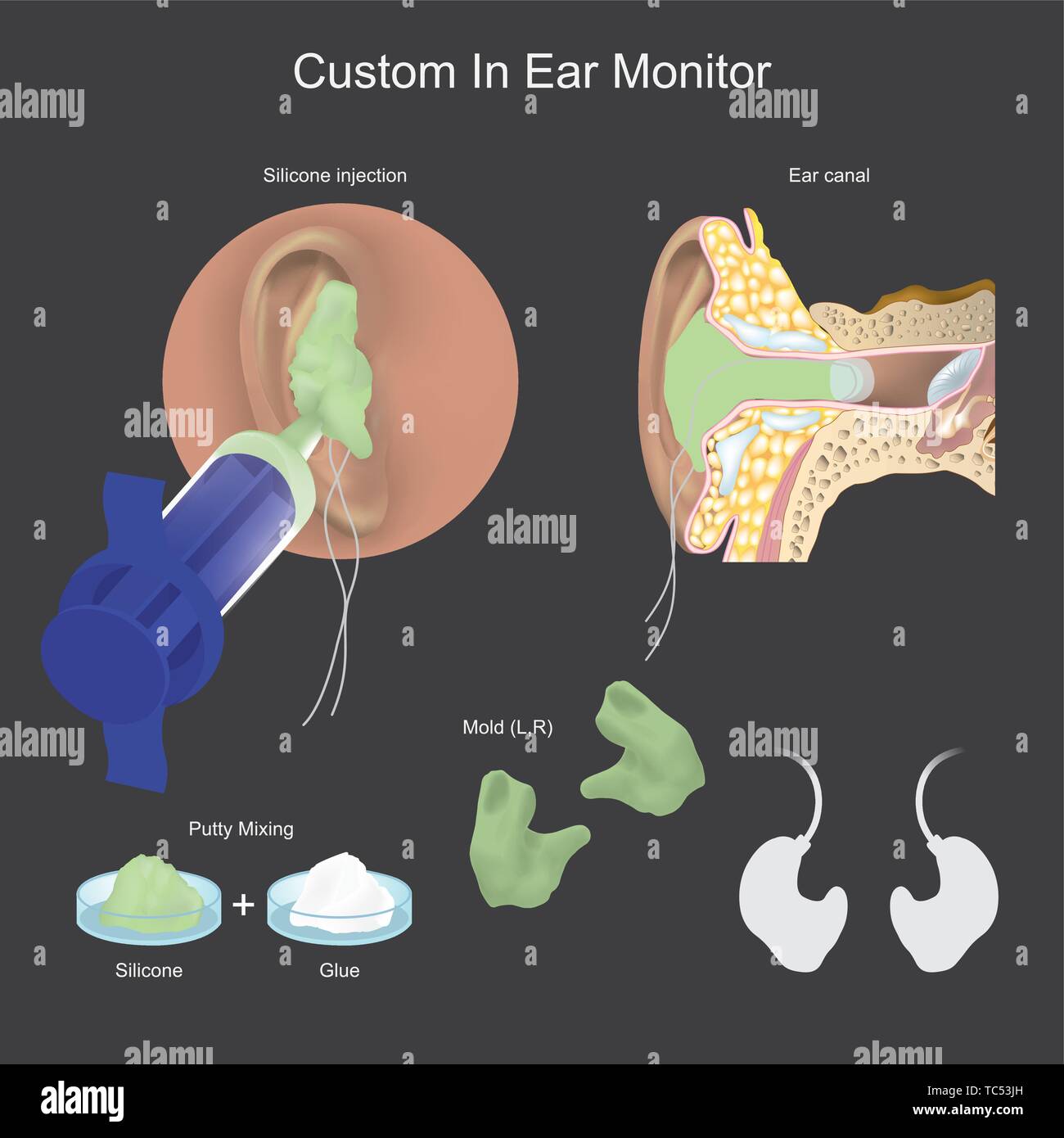 Kopfhörer, die speziell für das Persönliche die einzelnen Gehörgang ausgelegt sind. Stock Vektor
