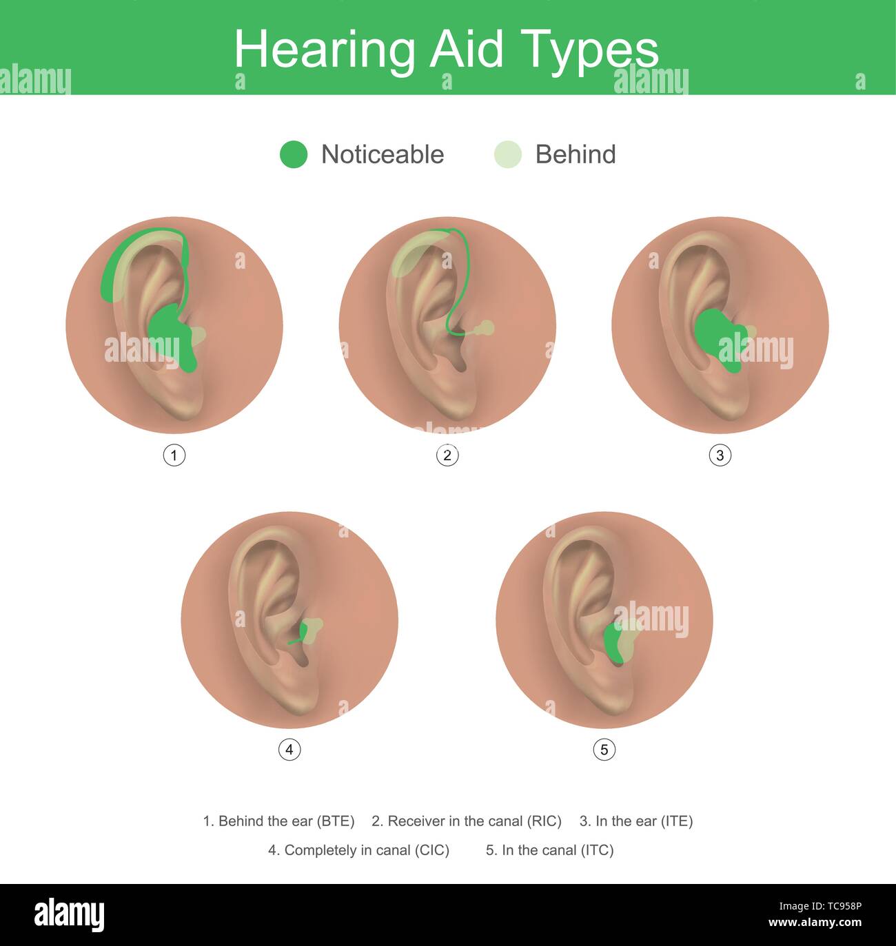 Hörgerät für Menschen mit Hörgeschädigten, Es gibt viele Formen von entsprechend zu wählen. Stock Vektor