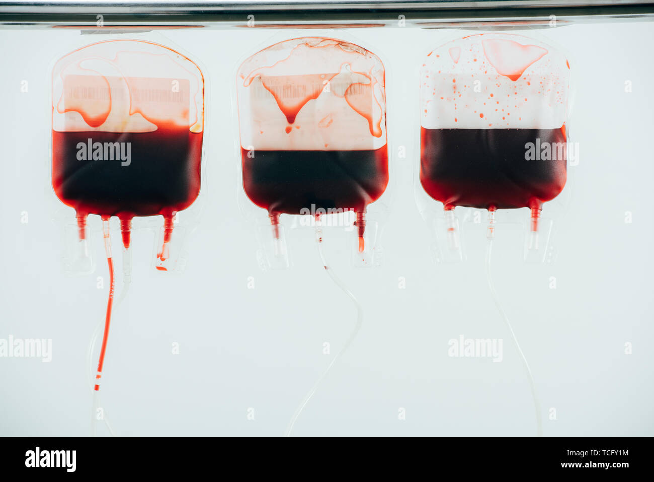 Kunststoff Blutbeutel mit gepackten Zellen isoliert auf weiss Stockfoto