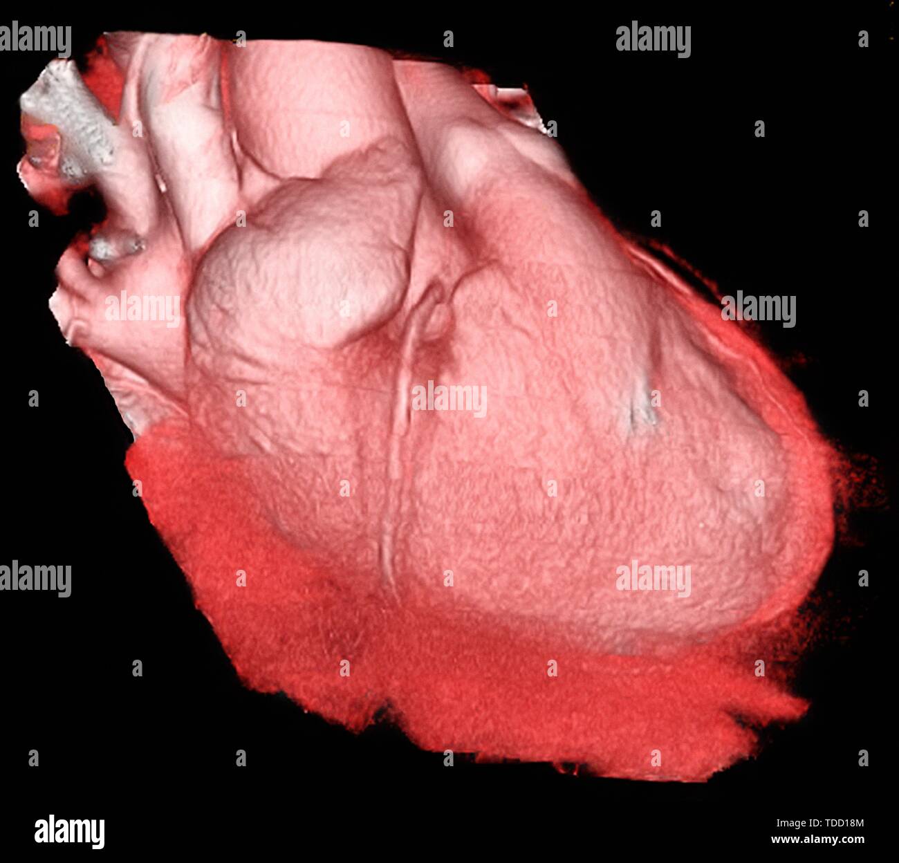 Gesundes Herz, 3-D-CT-Scan Stockfoto