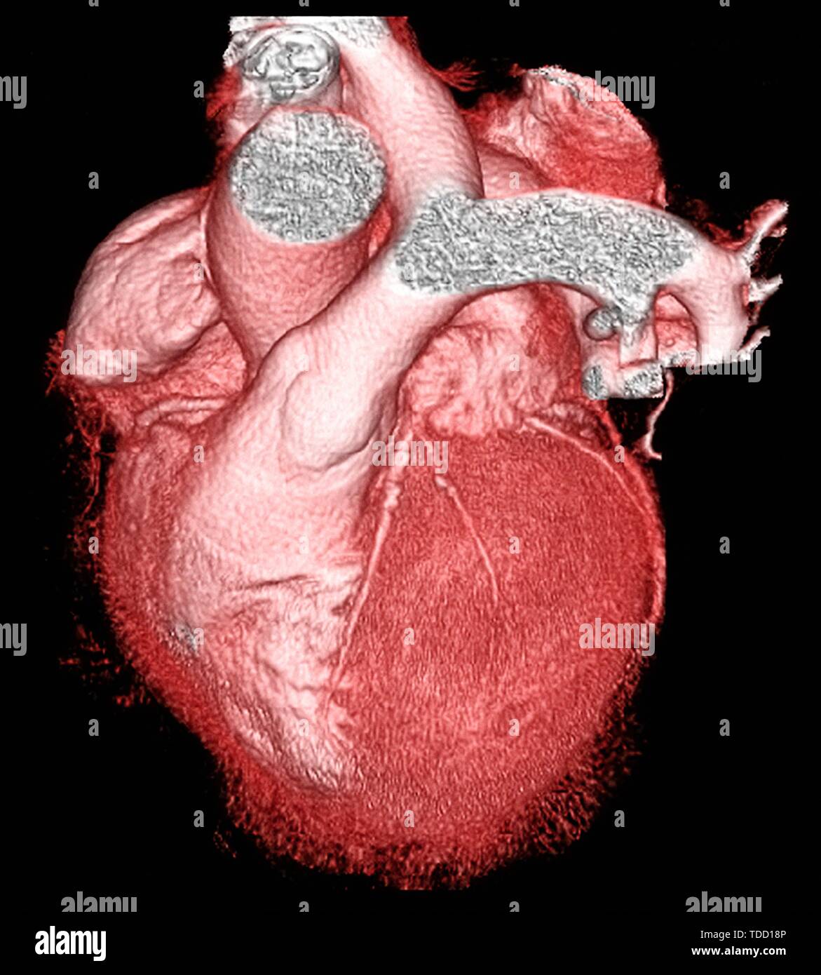 Gesundes Herz, 3-D-CT-Scan Stockfoto