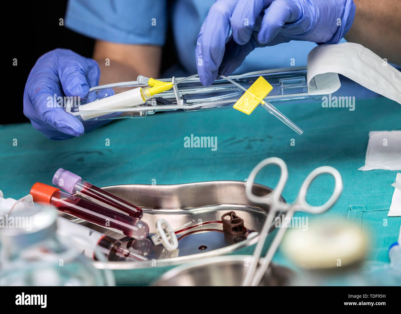 Krankenschwester bereitet Venenkatheter von langer Dauer in einem Krankenhaus, Zugriff auf die Innewohnung Zentralvenösen Linien, konzeptionelle Bild Stockfoto