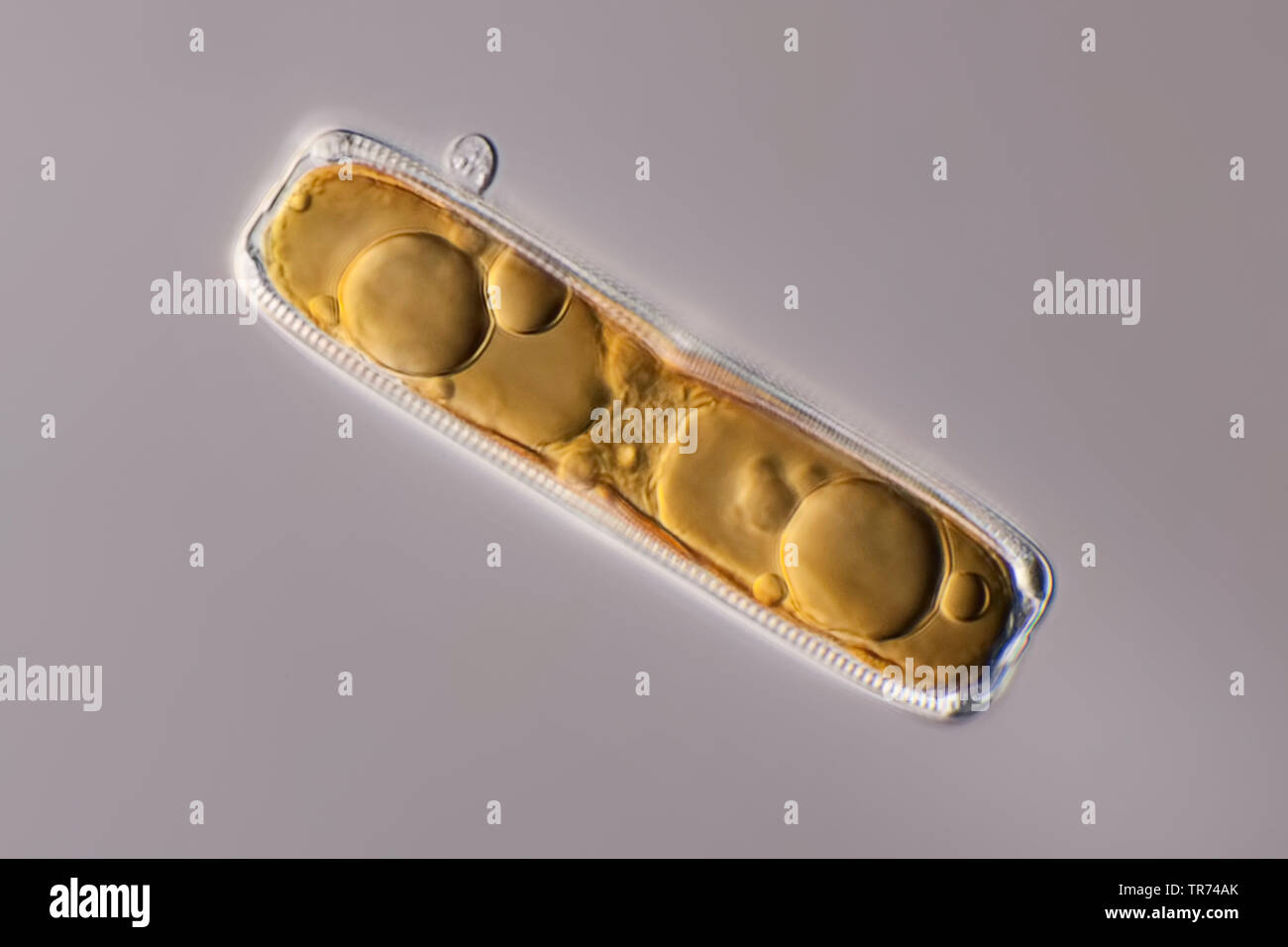 Diatomeen (Kieselalgen Diatomeae), Wohnzimmer von Tessin, in differential Interferenz Kontrast, x180, Schweiz, Tessin Stockfoto