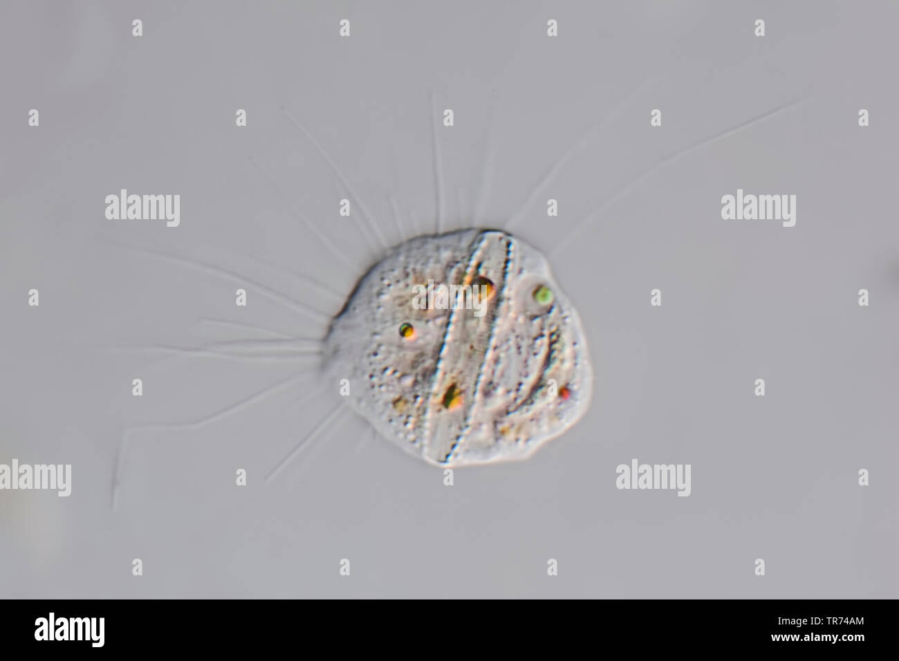 Amebas, Amöben (Amoebozoa), Wohnzimmer amöbe von Tessin, Differential Interferenz Kontrast Mikroskopie, x160, Schweiz, Tessin Stockfoto