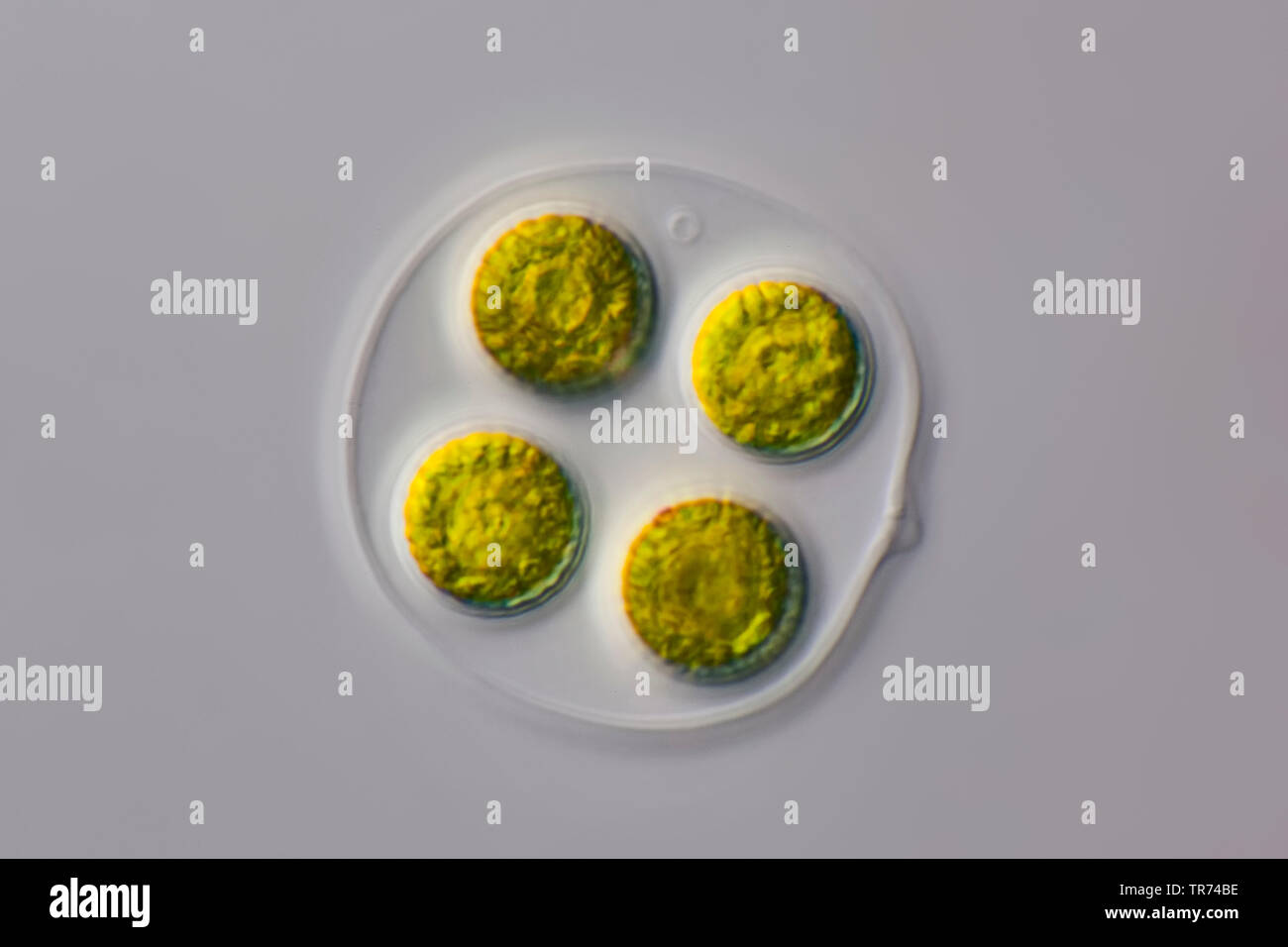 Gree Algen in einem transparenten gallertartige Umhüllung, Differential Interferenz Kontrast Mikroskopie, x100, Deutschland Stockfoto