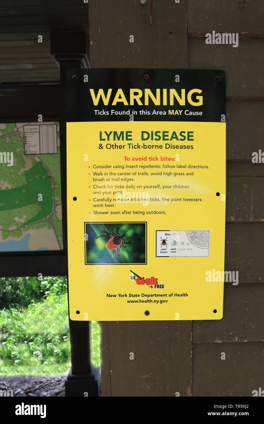 Lyme Krankheit Warnschild Long Island New York Stockfoto