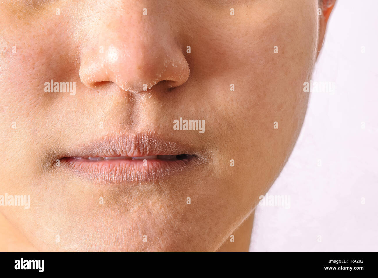 Trockene lippen -Fotos und -Bildmaterial in hoher Auflösung – Alamy